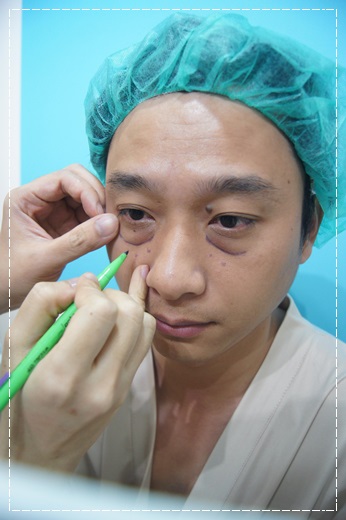 《高雄眼袋手術》推薦整形權威～割眼袋手術成功又順利，恢復快速又帥氣！這位醫師內外開眼袋手術都厲害！